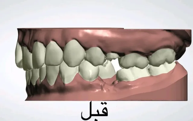 مختبر بيت المقدس لصناعة الأسنان 4