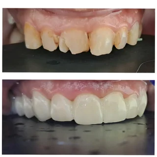 عيادة الدكتور محمد صايل الصوا طب و جراحة الفم والاسنان 12