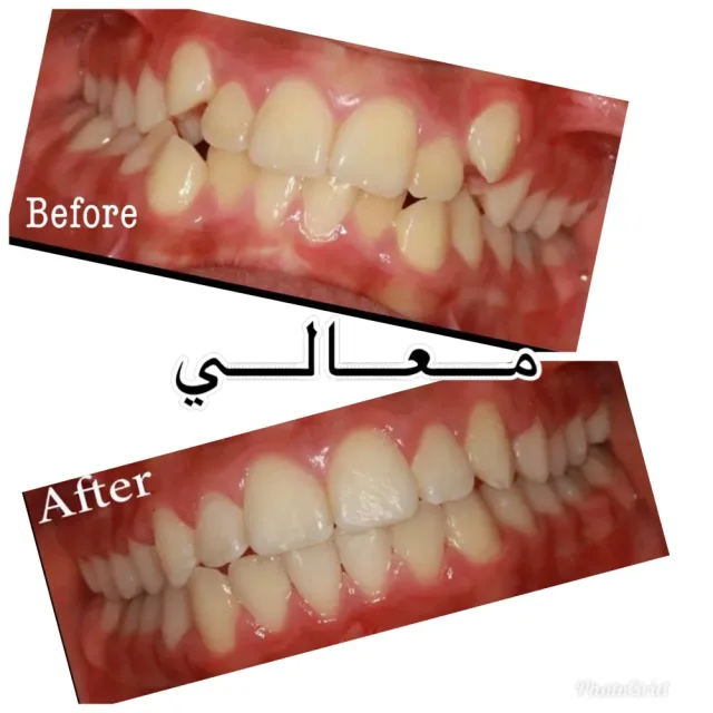 Maali Dental and orthodontic Center 3