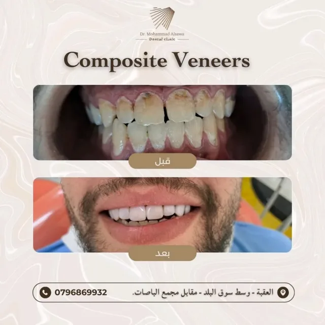 عيادة الدكتور محمد صايل الصوا طب و جراحة الفم والاسنان 2