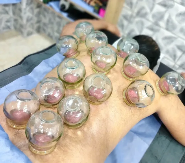 شرطةِ محجم للتداوي 10