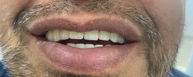 عيادات الصفدي والمومني لطب وزراعة وتقويم الاسنان 4
