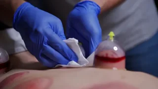 مركز حياه لخدمات الحجامة المنزلية (داخل عمان) 4