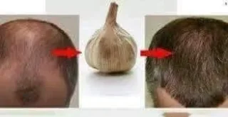 منتجات وخلطات طبيعية