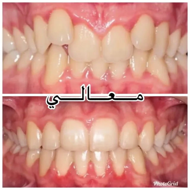 Maali Dental and orthodontic Center 5