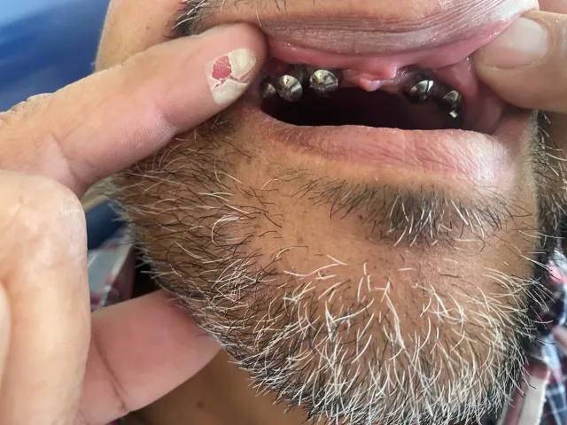 عيادات الصفدي والمومني لطب وزراعة وتقويم الاسنان 8