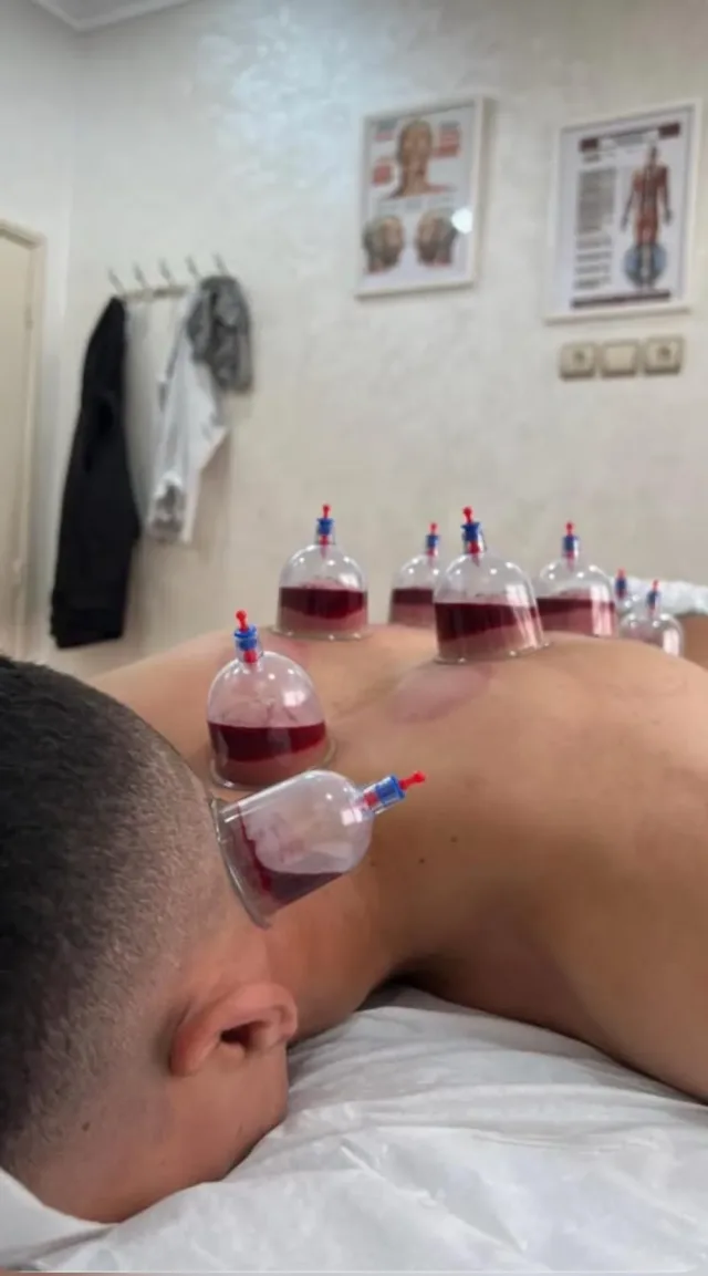 اخصائي مساج وحجامة 6