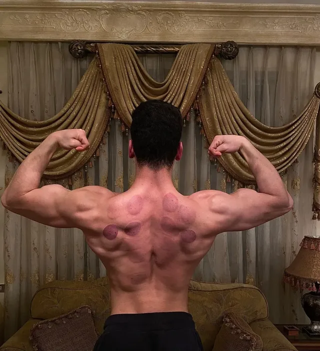 اخصائي مساج وحجامة 4