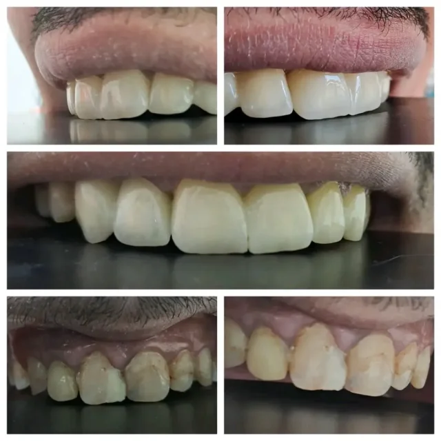 عيادة الدكتور محمد صايل الصوا طب و جراحة الفم والاسنان 9