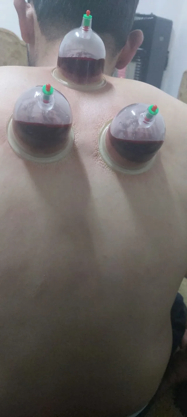 الرفاعي للرقية الشرعية والحجامة 2