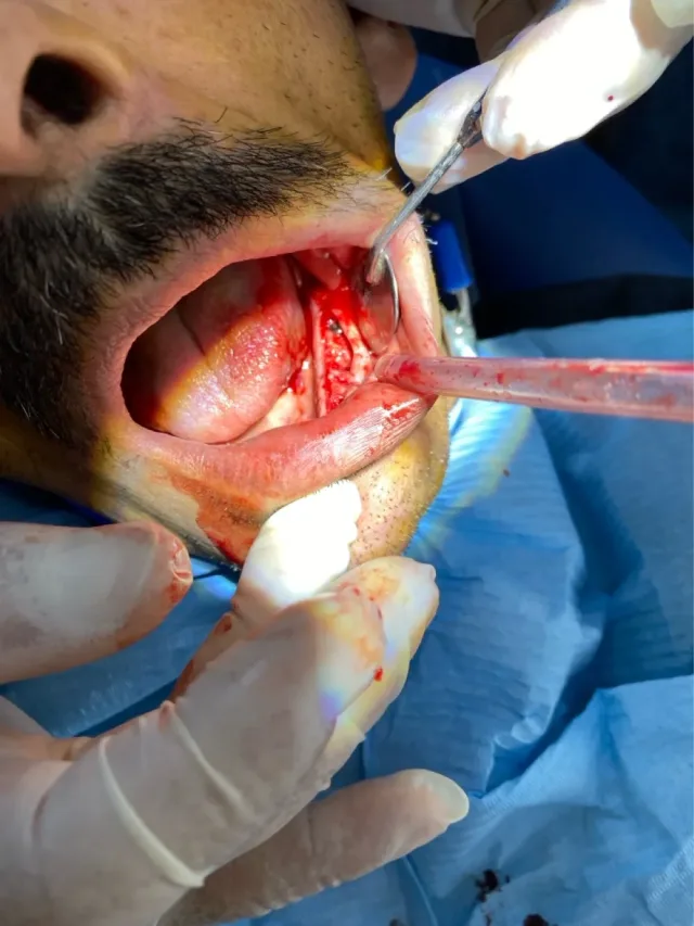 عيادات الصفدي والمومني لطب وزراعة وتقويم الاسنان 15