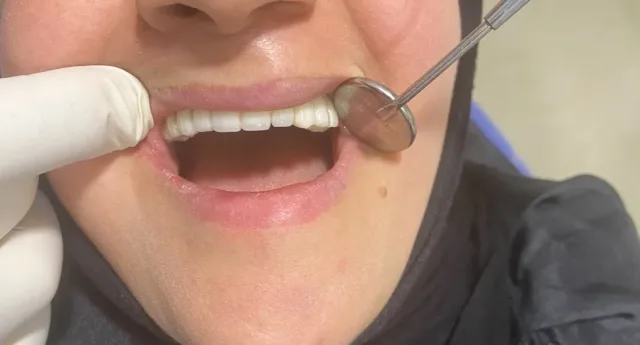 عيادات الصفدي والمومني لطب وزراعة وتقويم الاسنان 2