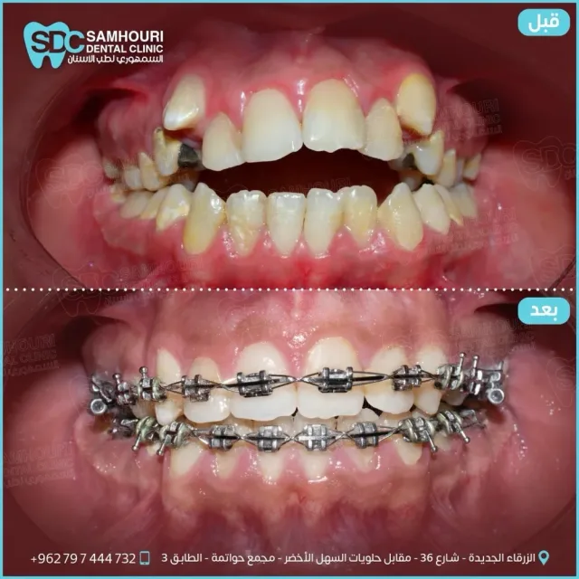 د.عبدالله السمهوري لطب وتقويم الأسنان 3