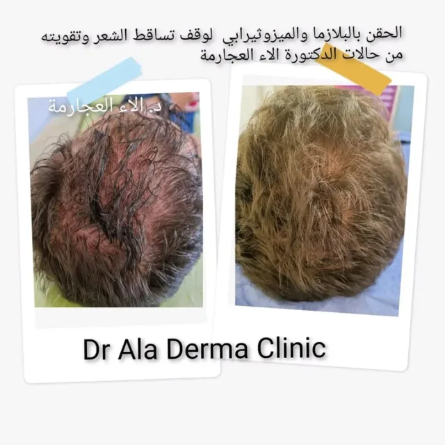 عيادة الدكتورة الاء العجارمة اختصاصية الامراض الجلدية