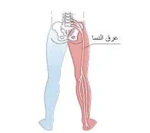 حجامة وزيوت وطب بديل ومساج علاجي 2