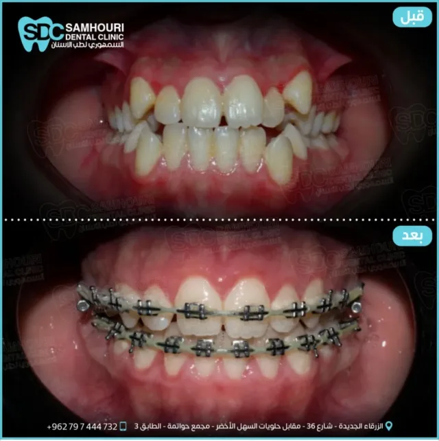 د.عبدالله السمهوري لطب وتقويم الأسنان 4