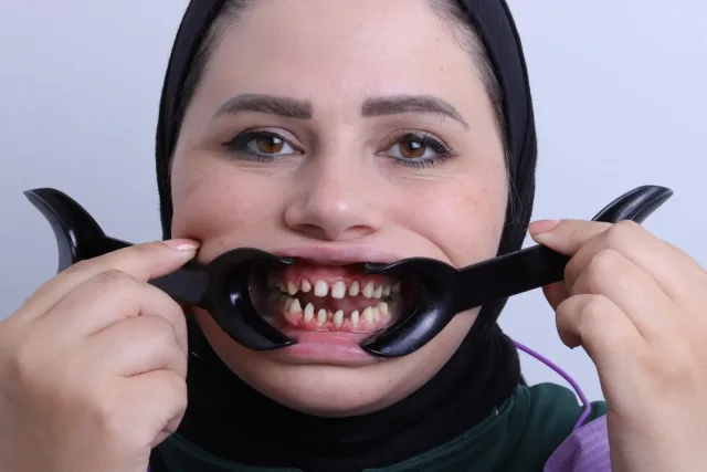 dr mohammad ziad dental clinic