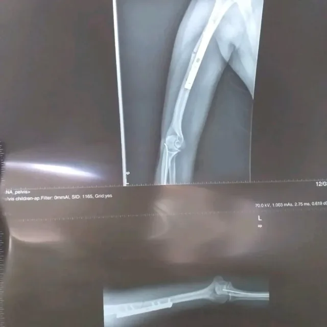 أجمل قوام للعلاج الطبيعي