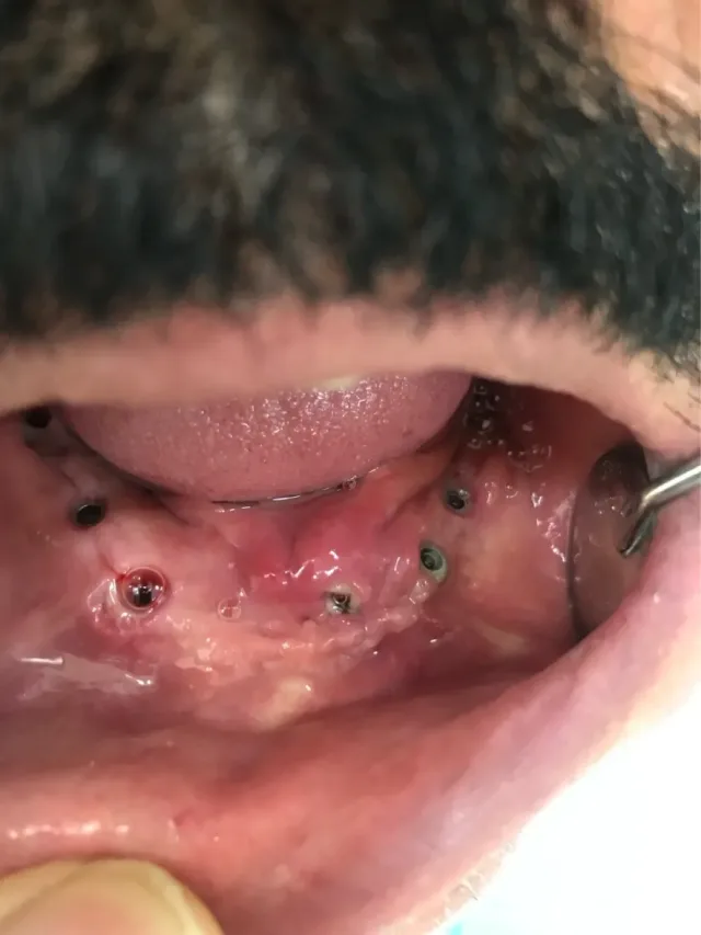 عيادات الصفدي والمومني لطب وزراعة وتقويم الاسنان 14