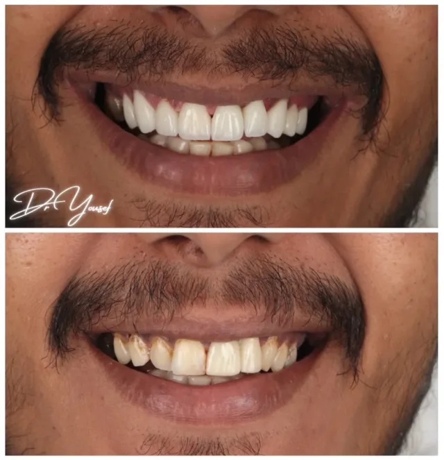 Dr Yousef Alramahi Dental Clinic