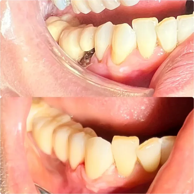 Dr Yousef Alramahi Dental Clinic