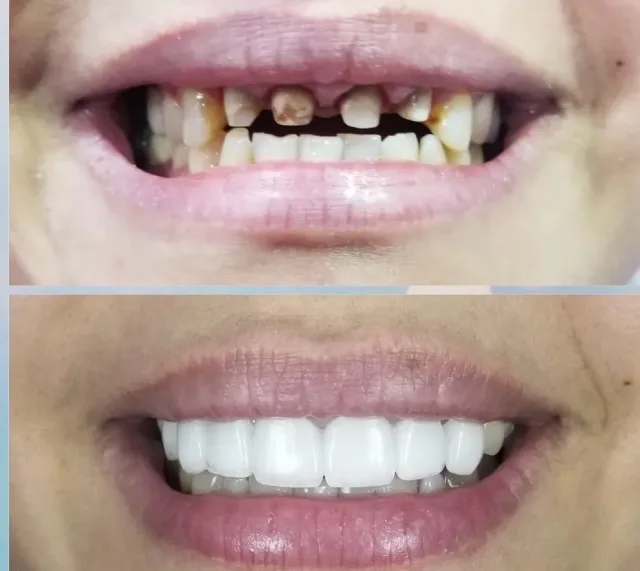 عيادة الدكتور صالح العليمي طب وجراحة الفم والأسنان 11