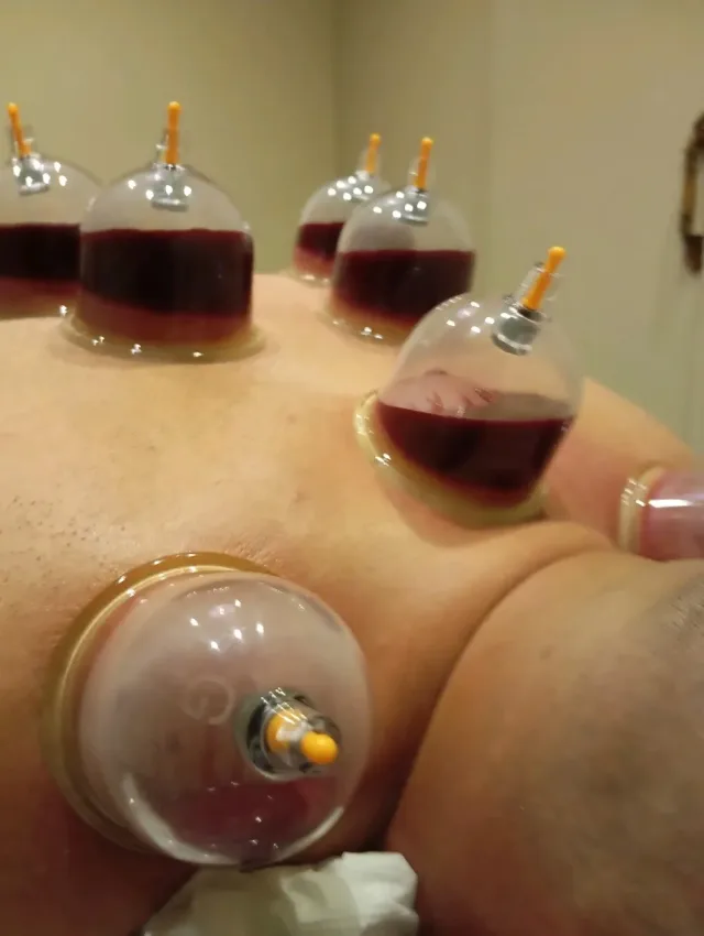 اخصائي مساج وحجامه 2