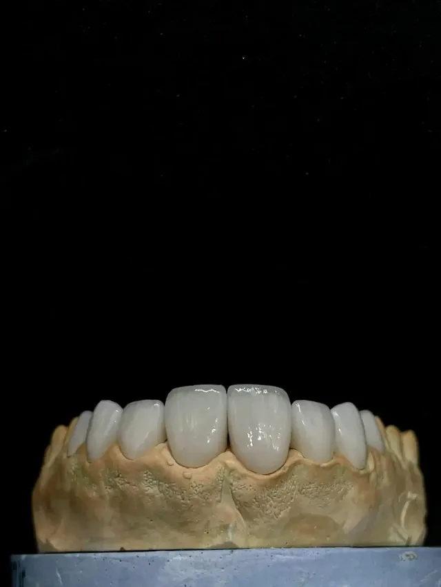 Glory  Dental lab 7