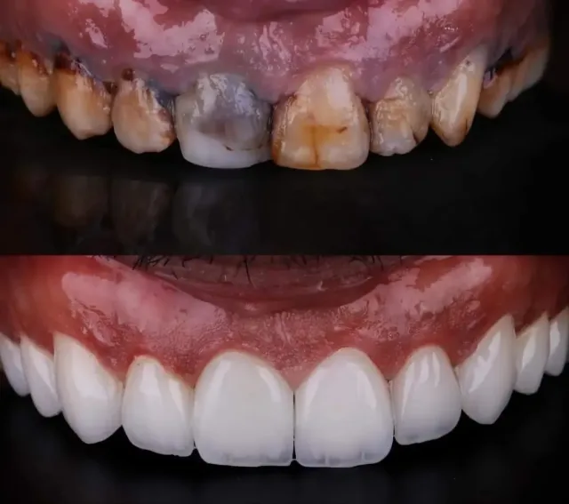 عيادة الدكتور صالح العليمي طب وجراحة الفم والأسنان 2