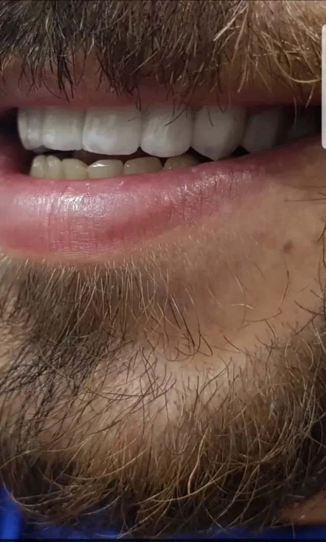 عيادة الدكتور صالح العليمي طب وجراحة الفم والأسنان 14