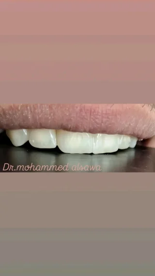 صانع أبتسامة