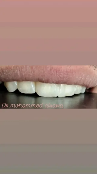 صانع أبتسامة