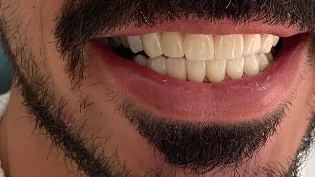 عيادة الدكتور صالح العليمي طب وجراحة الفم والأسنان 5
