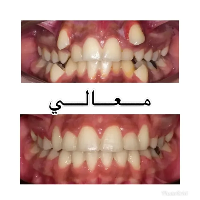Maali Dental and orthodontic Center 2