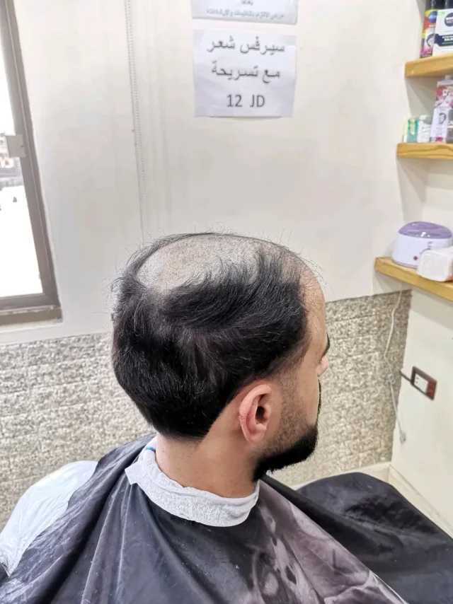 Dr. Hair 8
