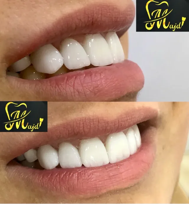 مركز التميز لطب الاسنان 2