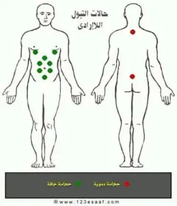 حجامة وزيوت وطب بديل ومساج علاجي 4