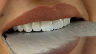 عيادة الدكتور زيد العمري لزراعة وتجميل الاسنان 10