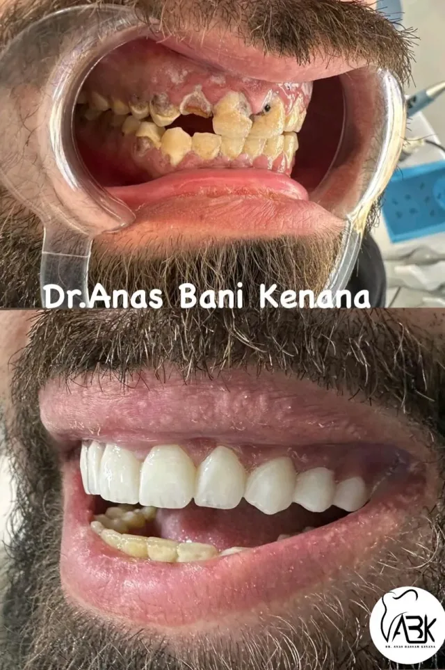 الدكتور أنس بسام بني كنانة (طبيب أسنان) 5