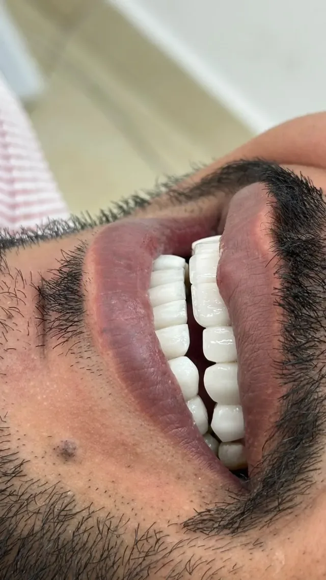 مختبر امجد دولة لتركيبات الاسنان والتحميل 6