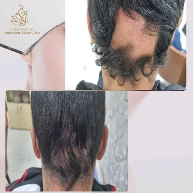 عيادة الدكتورة الاء العجارمة اختصاصية الامراض الجلدية