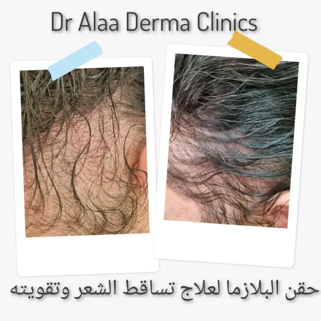 عيادة الدكتورة الاء العجارمة اختصاصية الامراض الجلدية
