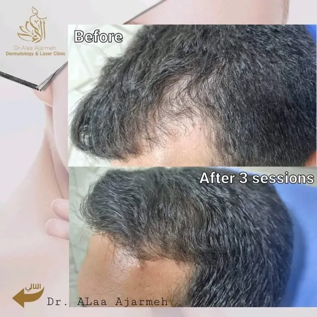 عيادة الدكتورة الاء العجارمة اختصاصية الامراض الجلدية