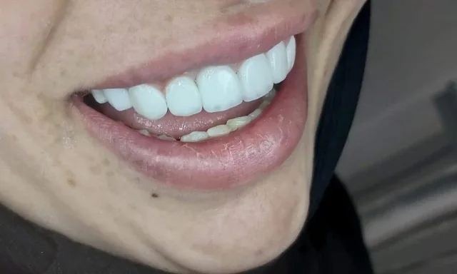 عيادة الدكتور صالح العليمي طب وجراحة الفم والأسنان 10
