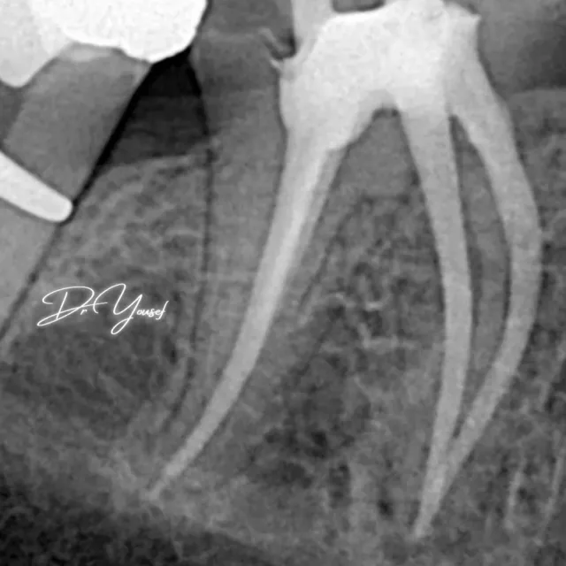 Dr Yousef Alramahi Dental Clinic
