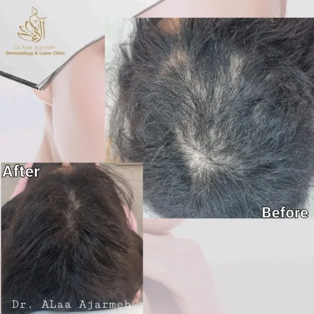 عيادة الدكتورة الاء العجارمة اختصاصية الامراض الجلدية