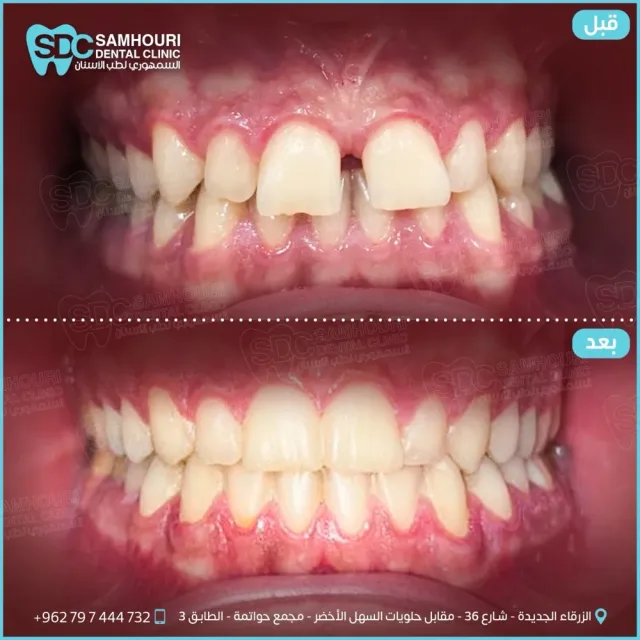 د.عبدالله السمهوري لطب وتقويم الأسنان 5