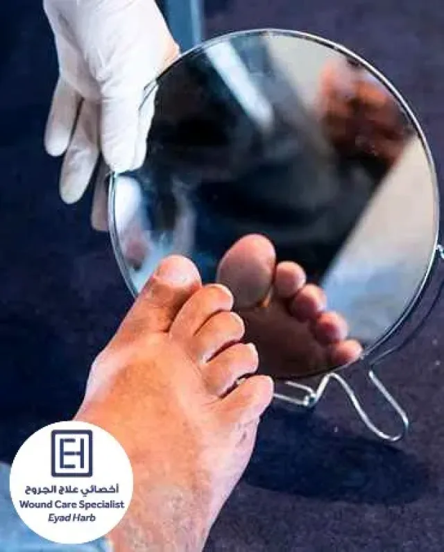 عيادة الجروح والتقرحات والقدم السكري 6