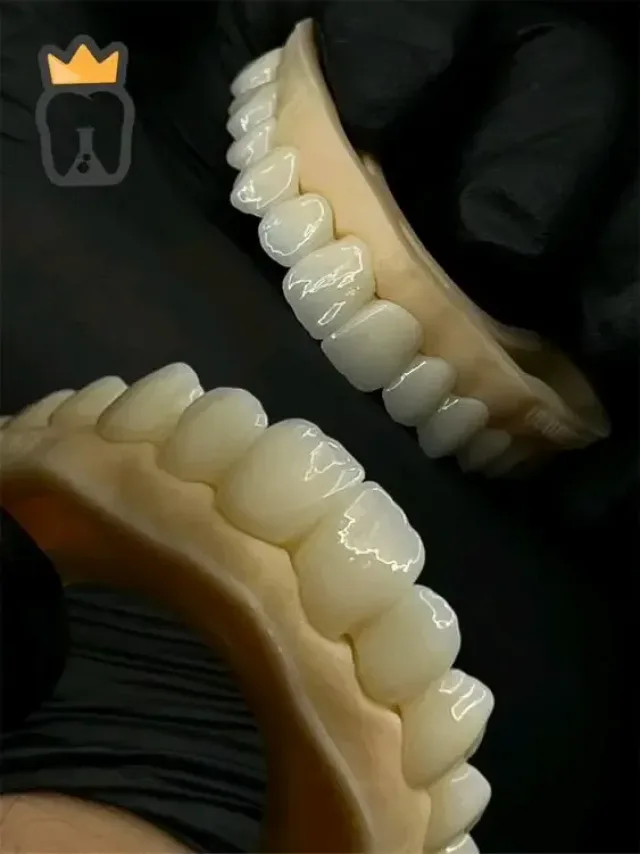 Glory  Dental lab 2