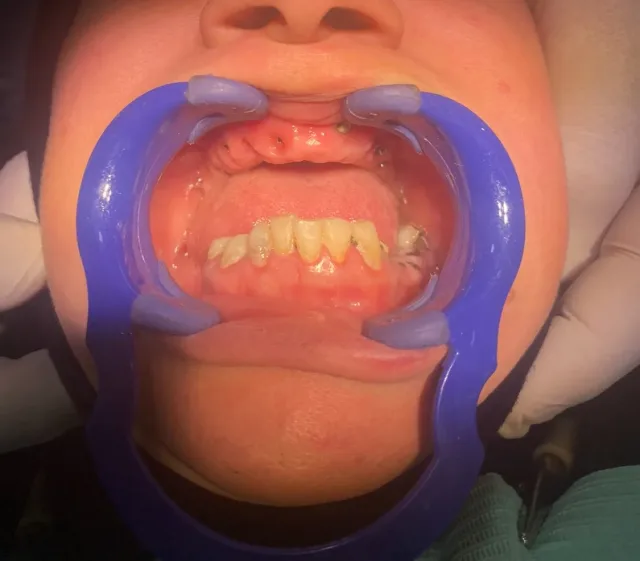 عيادات الصفدي والمومني لطب وزراعة وتقويم الاسنان 3